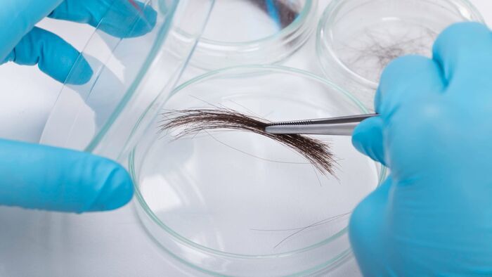 Epilation et hypnose