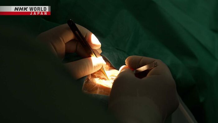 Glaucoma: The Fight to Prevent Blindness