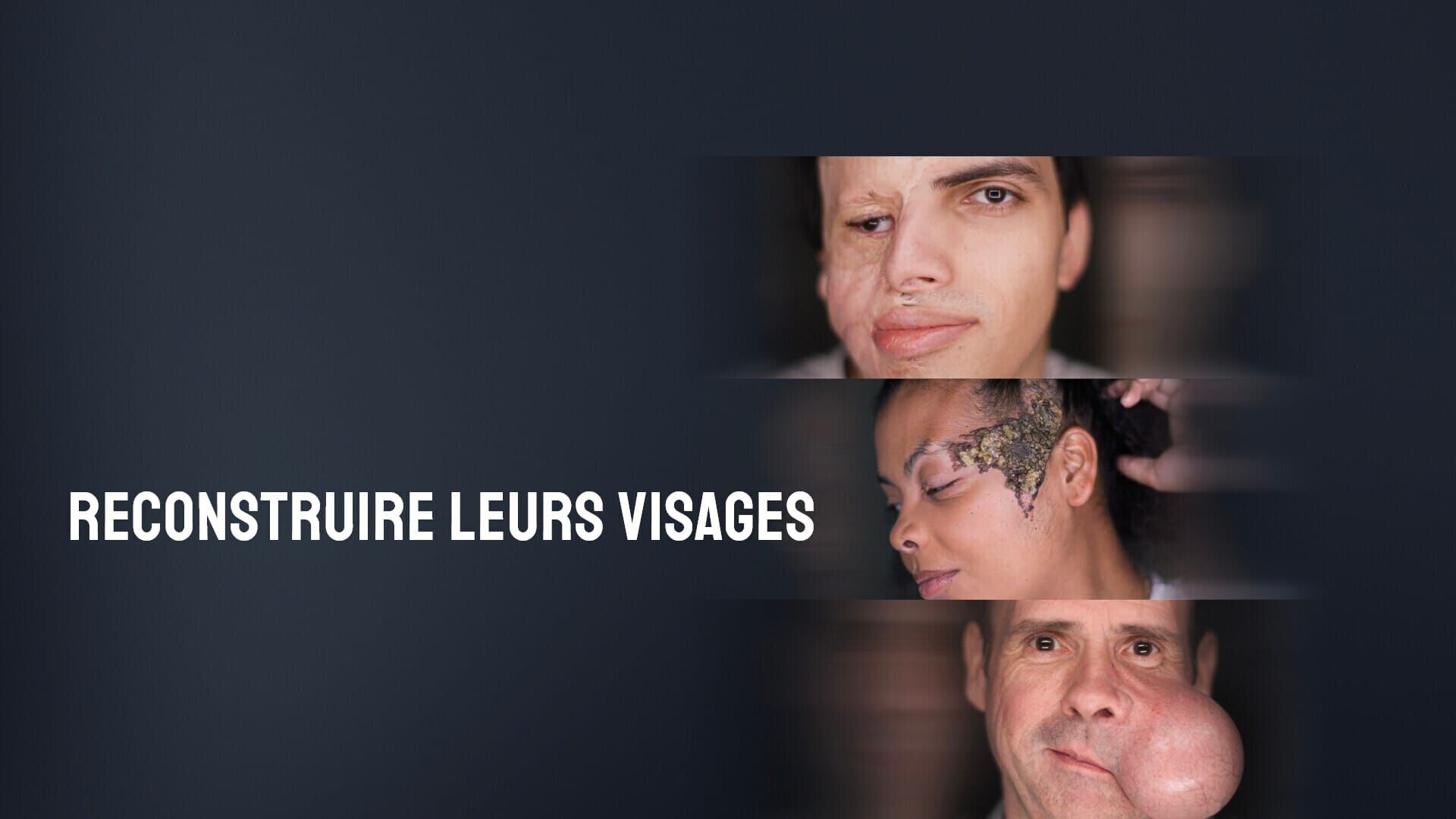 L'invasion de la tumeur