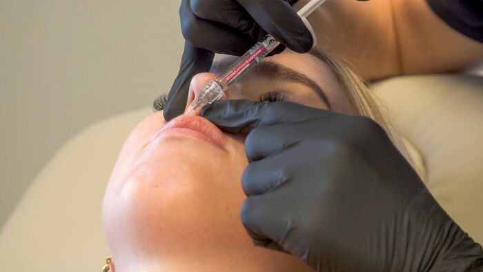 The New Face - The Hyaluronic Acid Beauty Hype