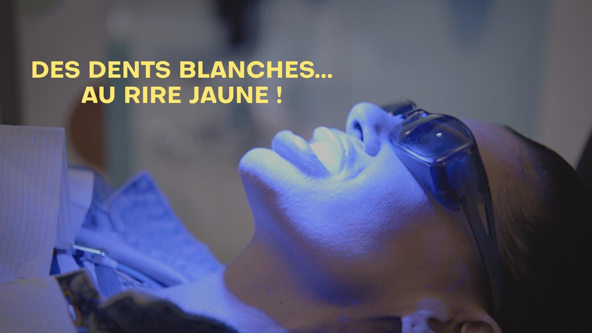 Des dents blanches... au rire jaune !