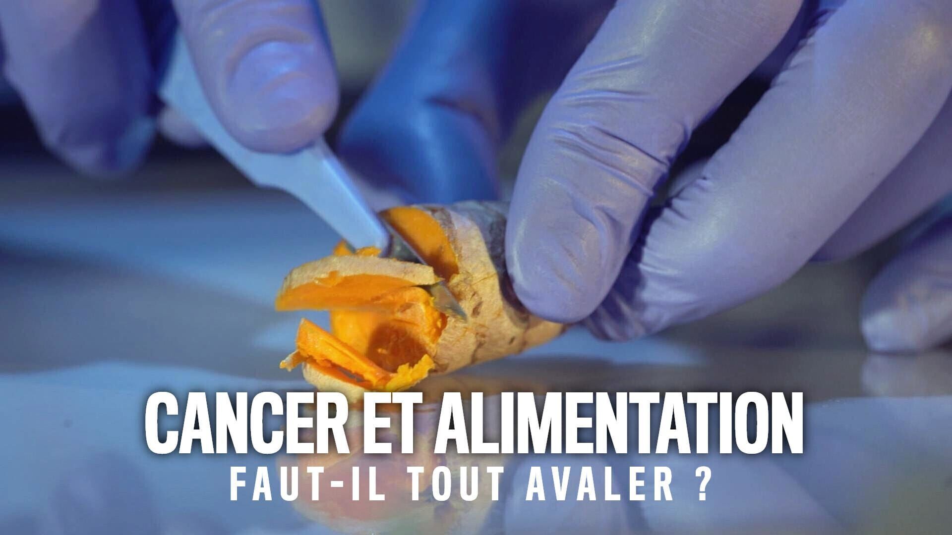 Cancer et alimentation, faut-il tout avaler ?