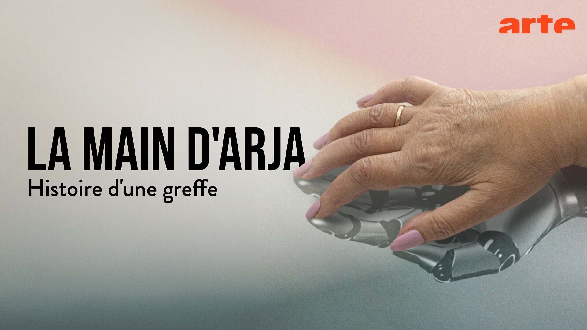 La main d'Arja : histoire d'une greffe