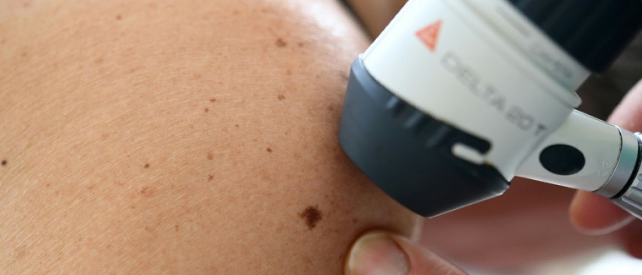 Les dermatologues à fleur de peau sur la question de leurs effectifs
