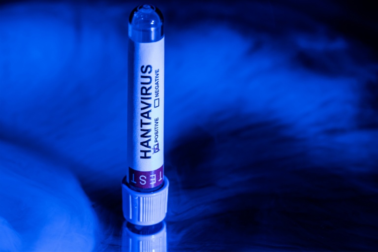 Hantavirus: pour les experts, le défi d'informer sans réveiller la peur du Covid