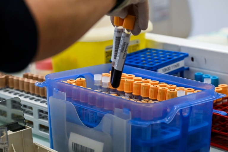 Biologie médicale: un réseau de laboratoires visé par une attaque informatique