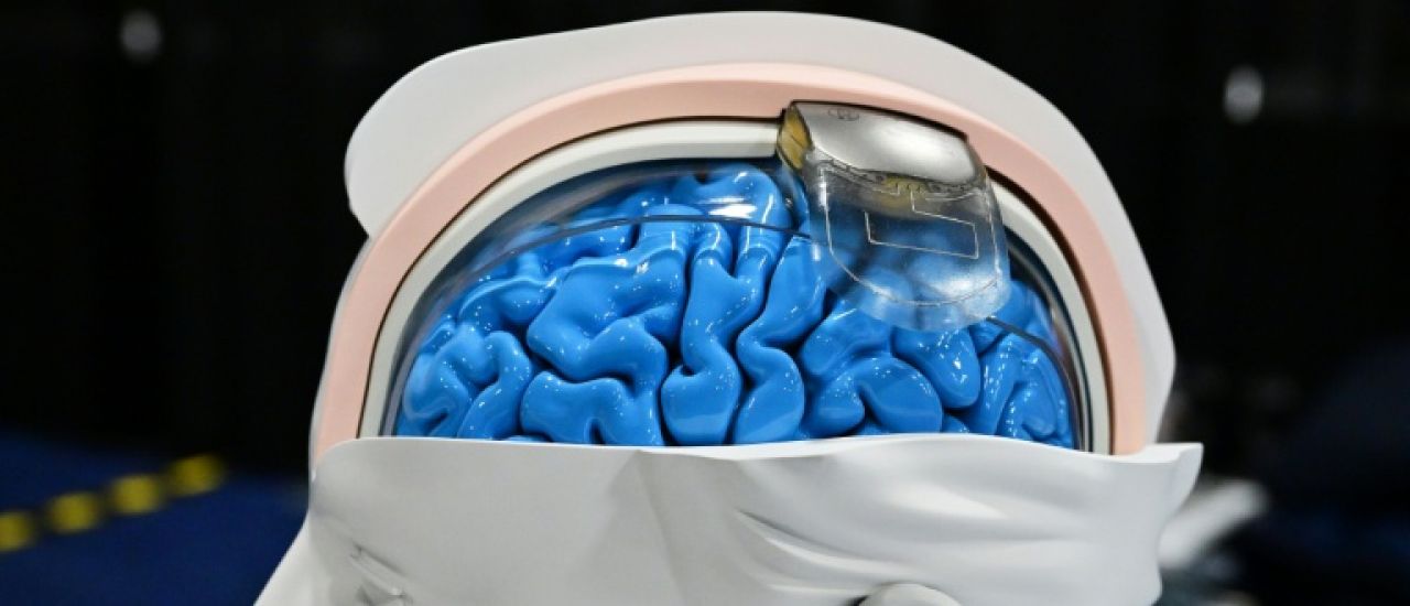 "On est déjà dans la science-fiction": la discrète révolution des neurotechnologies